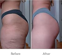 COCUNAT Body Power Anti Cellulite Cream 150ml + 125ml — image 7