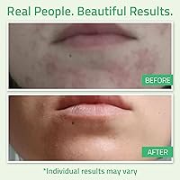 YEOUTH Glycolic Acid Peel 30% with Retinol 2oz — image 4