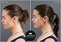 CROWN Hair Building Fibers Dark Brown 28g — image 4