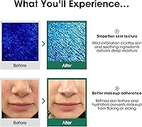 SOME BY MI AHA BHA PHA 30 Days Miracle Toner – Pack of 2 — image 5