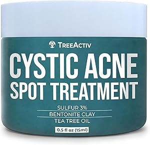 TreeActiv Cystic Acne Spot Treatment 0.5oz Review
