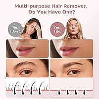 Gurelax Facial Hair Remover 2-in-1 Gold — image 7