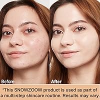 SnowZoom Foundation 4 in 1 Medium Spectrum SPF 50+ Full Coverage Concealer 1oz — image 2