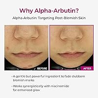 Dr.Melaxin Cemenrete Picotonic Shot Calcium Serum 1.01 fl.oz. — image 6