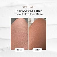 HealFast KP Bump Eraser Cream 4oz — image 5