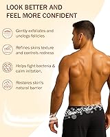 e70 Folliculitis Cream – 4 oz — image 2