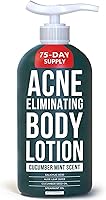 TreeActiv Acne Eliminating Body Lotion 8oz — image 1