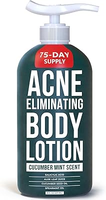 TreeActiv Acne Eliminating Body Lotion 8oz