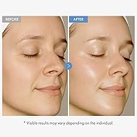 TOSOWOONG Hyaluronic Acid 9 Cream, 50mL — image 3