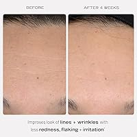 First Aid Beauty 0.3% Retinol Complex Serum with Peptides 1oz — image 3