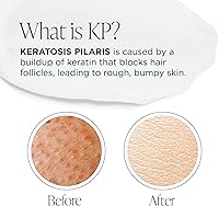 Glytone KP Kit – Exfoliating Body Wash & Glycolic Acid Lotion — image 3