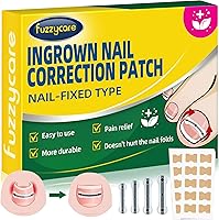 Fuzzycare Titanium Alloy Ingrown Toenail Treatment Kit, 10 Pcs — image 1
