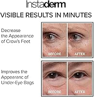Instaderm Instant Eye Tightener 30mL — image 4