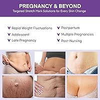 Stretch Mark Cream for Pregnant Women - 4 Oz — image 4