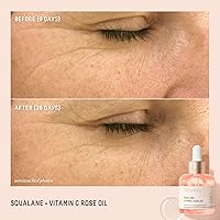 Biossance Rapid Radiance Set — image 6