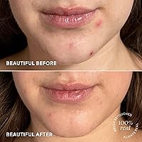 TULA Skin Care Brightening Treatment Drops - Vitamin C Serum, 1 fl oz — image 8