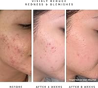 HERBIVORE Lapis Balancing Facial Oil 1oz — image 5