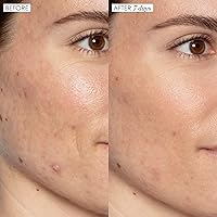 Sunday Riley Good Genes Lactic Acid Treatment 1.5oz — image 4