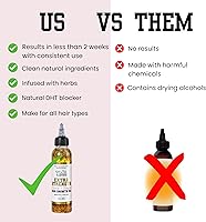 The Mane Attraction Extra Strength Rosemary + Fenugreek Herbal Hair Growth Oil 4oz — image 8