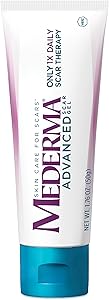 Mederma Skin Care for Scars, 1.76 Ounce Review