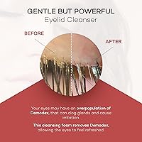 Zocular ZocuFoam Eyelid Cleanser 1.7oz — image 4