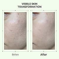 Orien Propolis Niacinamide Glow Serum 1.01 fl.oz. — image 6