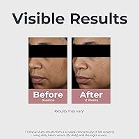 Eucerin Radiant Tone Dual Serum Dark Spot Corrector 1 Fl Oz — image 6