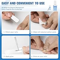 Asinkiher Titanium Alloy Ingrown Toenail Treatment Kit — image 5