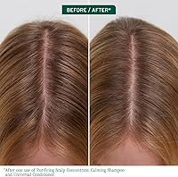 Biolage Scalp Sync Purifying Concentrate 6.8oz — image 2