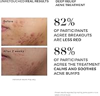 Dermlogic Acne Treatment Pads - 2% Salicylic Acid, Exfoliating, Unscented — image 5