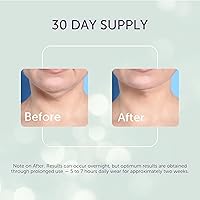 SilcSkin Collette Neck Wrinkle Pad — image 7