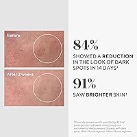 Murad Rapid Dark Spot Correcting Serum Travel Size 0.33oz — image 3