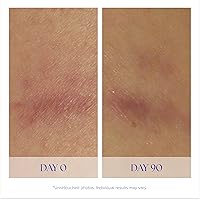 iS CLINICAL Super Serum Advance+ 3.84oz — image 4