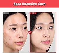 TOSOWOONG Ovalicin Skin Clear Cream 50g — image 2