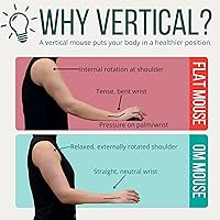 Ergodriven Om Handshake Vertical Mouse — image 3