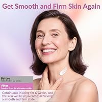 VicGFHS Neck Firming Cream with Collagen & Hyaluronic Acid, 1.7oz — image 5