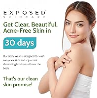 Exposed Skin Care Body Acne Wash 12oz — image 9
