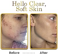 LUXEBEAUTY Non-Greasy Hyaluronic Acid Moisturizer 2oz — image 5