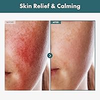 TOSOWOONG Adenosine Cica Cream 100ml — image 2