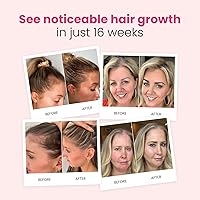 Trybello Hair Growth Shampoo 10oz — image 6