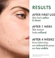 VICHY Normaderm Acne Control Daily Moisturizer 50mL — image 4