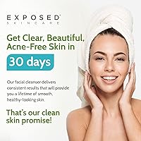 Exposed Skin Care Acne Facial Cleanser 4oz — image 9