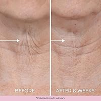 DEKLIDERM Neck Firming Cream 1.69oz — image 7