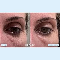 NuFACE IonPlex Hydra-Gel Power Under Eye Patches - 60 Count — image 6