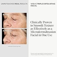 Murad Vita-C Triple Exfoliating Facial 2.7 Fl Oz — image 3