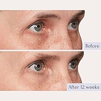 Tru Alchemy Eye Elixir Cooling Eye Treatment Cream 0.5oz — image 3