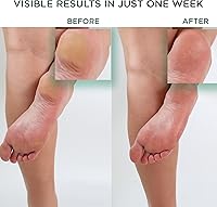 Hey Honey Walk the Walk Propolis Foot & Heel Cream 5oz — image 2