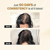 Nourish Mantra Advanced Hair Growth Serum 50ml — image 4