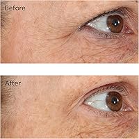 Perricone MD Essential Fx Acyl-glutathione Eyelid Lift Serum, 0.5 oz — image 4