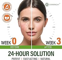 GRAMRIGHT Acne Treatment Face Cream 4 fl.oz — image 3